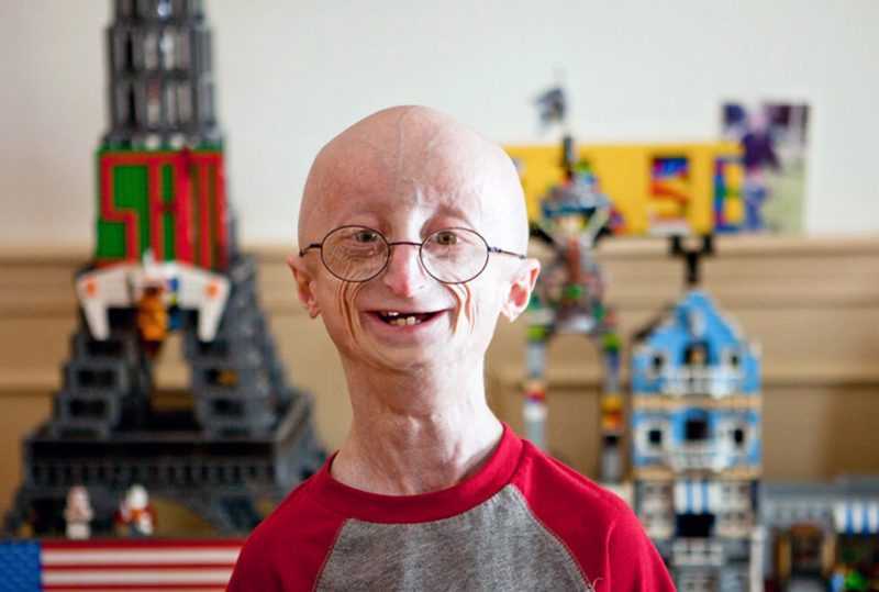 Орфанные заболевания — что это такое, перечень и список